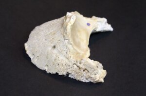 Coffin bone showing deterioration from Navicular Disease